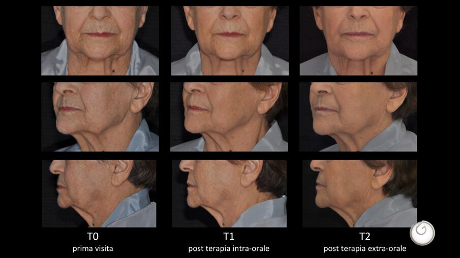 Presentazione standard di PowerPoint