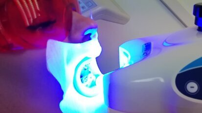 BlancOne Click a supporto della crescita dello studio dentistico