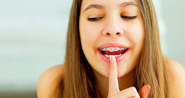 Confermata la relazione tra trattamento ortodontico precoce e qualità della vita correlata alla salute orale