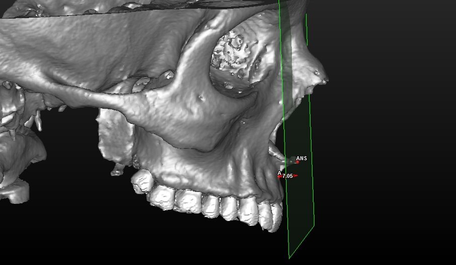 Fig. 7_Valutazione della componente scheletrica.