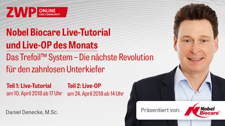 Nobel Biocare Live-Praxis-Tutorial & Live-OP: Das Trefoil System