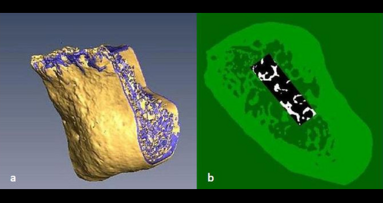 Cone Beam CT net zo effectief als standaard (micro-)CT-scan
