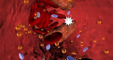 Lijekovi za holesterol pomažu pri smanjenju upale desni kod srčanih bolesnika