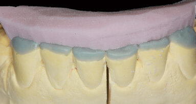 Minimální invazivita – maximální efektivita: Paradigma současné dekády záchovné stomatologie