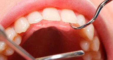 Grote donatie aan ACTA-onderzoek naar antioxidanten