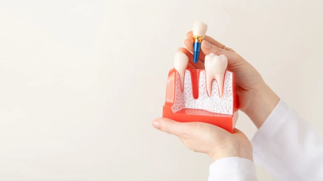 Интелигентно обучение за по-добри грижи за имплантите: Keystone Dental пуска нова онлайн платформа за обучение