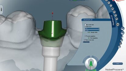 Sécurité et fiabilité avec la technologie CFAO