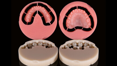 Celkové náhrady kompletně zhotovené metodou CAD/CAM