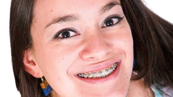 AAO expands its Donated Orthodontic Services program to include more children