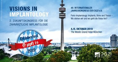 2. Zukunftskongress der DGZI mit Live-OPs & Table Clinics