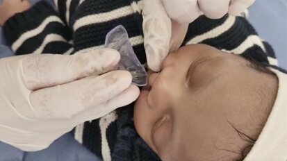 Colocando una placa ortopédica a Jesús