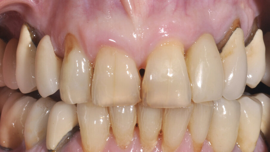 Fig. 10_Aspetto clinico a 90 giorni.