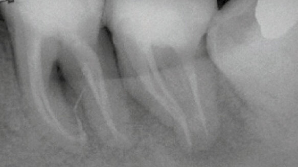 Photon Induced Photoacoustic Streaming