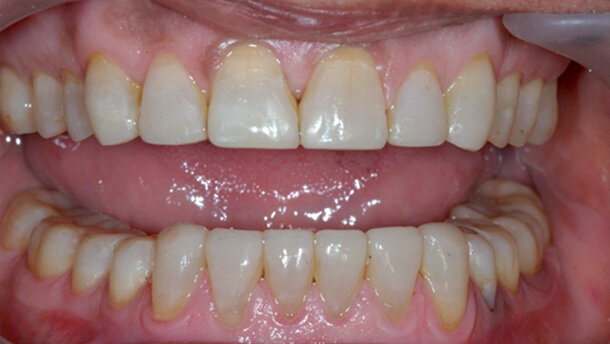 MiCD: Nepoškozujte kosmetickou stomatologií – část I.