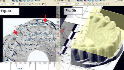 Identifizierung von Toten mittels forensischer Odontologie Identifizierung von Toten mittels forensischer Odontologie