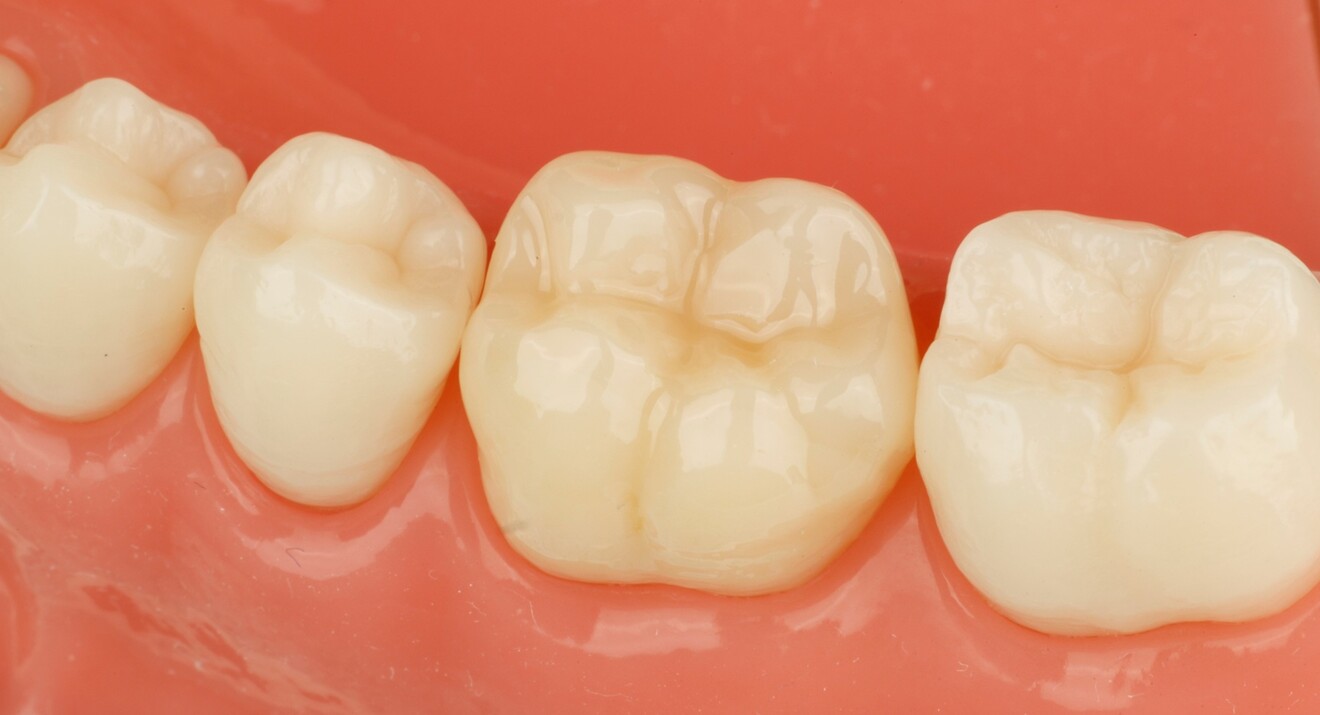Fig. 2f: Final outcome. 