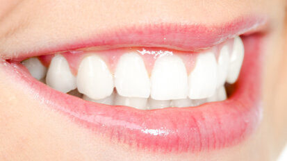 Früherkennung von Zwischenraumkaries mit Infrarotlicht getestet Früherkennung von Zwischenraumkaries mit Infrarotlicht getestet