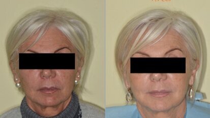 Caso di estetica multidisciplinare