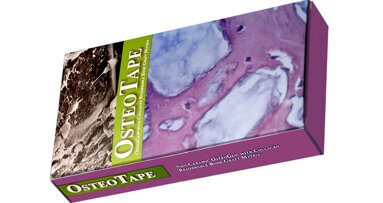 Impladent Ltd. announces breakthrough in innovative preformed porous bone graft technology