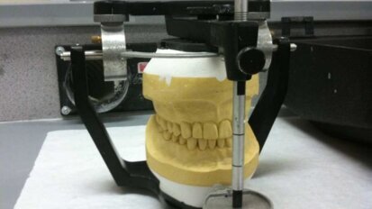 Dr Jayant Palaskar receives US and EU Patents for his invention on Centric Relation (CR) recording