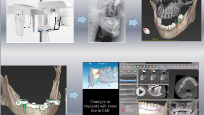 Κλινικά συστήματα Cad-Cam ...Μύθοι και Πραγματικότητα