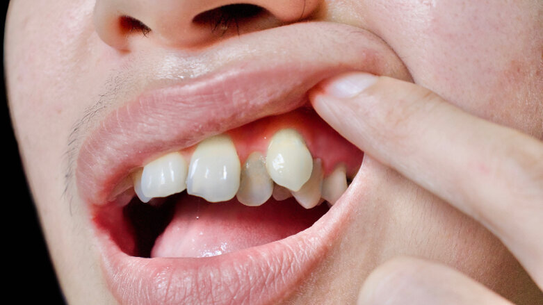 China emerging as key orthodontics and clear aligner market