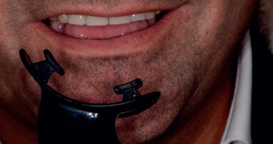 La concordance dei protocolli operativi domiciliari e professionali per il benessere del sorriso in un paziente che pratica sport agonistici: case report