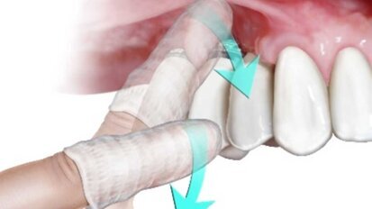 Confermata l’efficacia dello strofinamento con garza nell’eliminazione del Covid-19 dal cavo orale