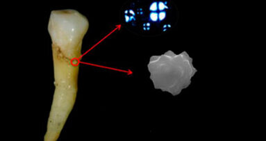 Isola di Pasqua: una placca dentale fa scoprire l’utilizzo di una pianta fondamentale nella dieta preistorica