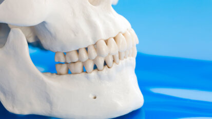 Orthopaedic treatment in Class II cases—clinical considerations