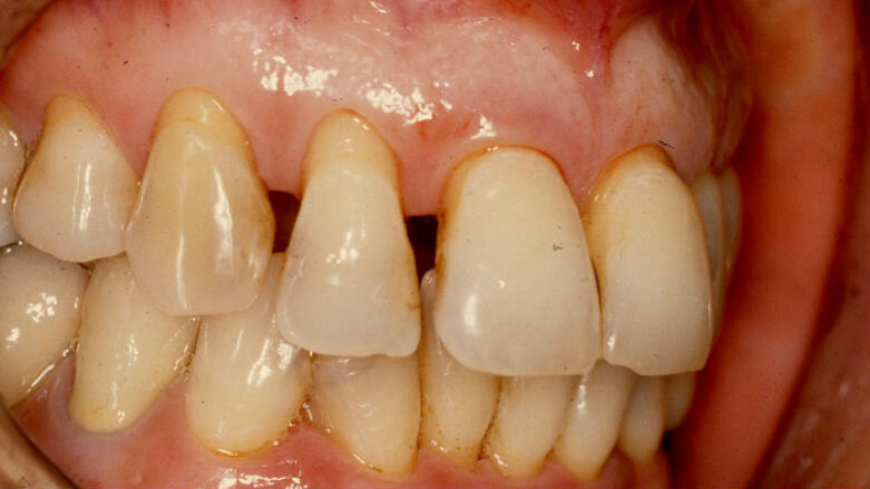 “Malpractice” e conoscenze specifiche del CTU: un caso paradigmatico