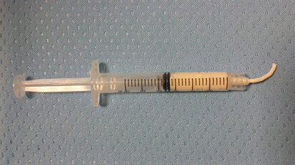 Il DBGRaft-T evoluzione studiata in particolare per l’applicazione in ambito odontostomatologico della pasta d’osso DBGraft prodotta e distribuita dalla BCTM dal 2011