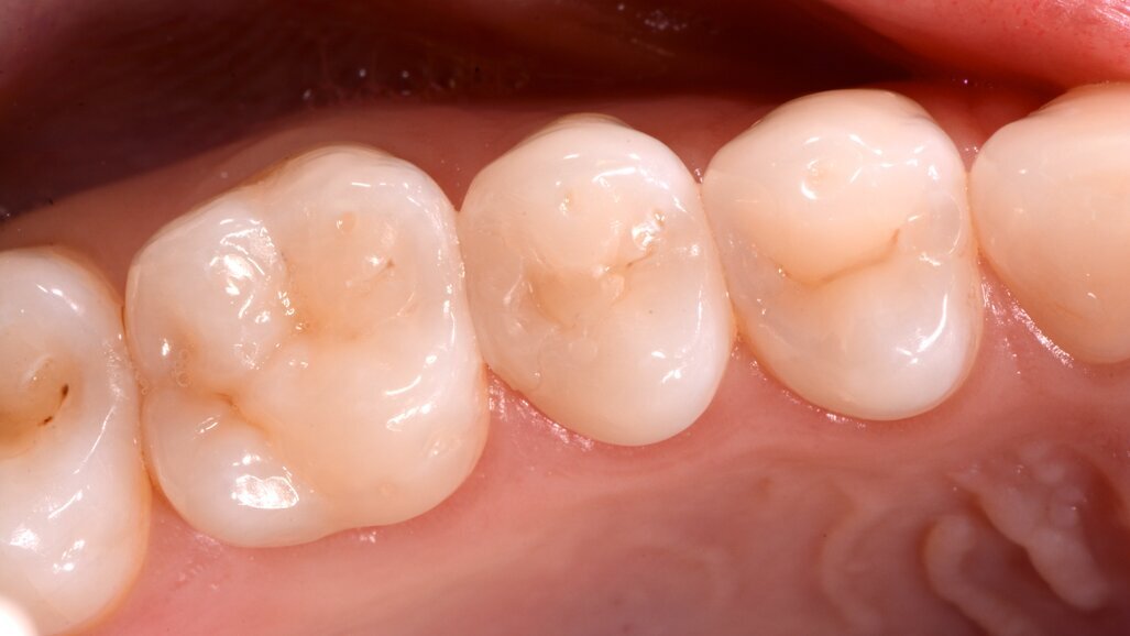 Los adhesivos univerales