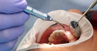 Studie: Laserlicht löst Kronen, Veneers und Brackets
