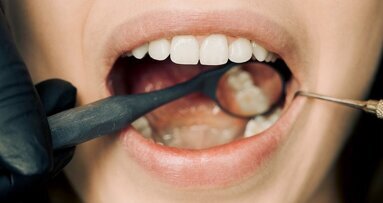 Diş Tedavisi Ücretlerine Güncelleme Geldi