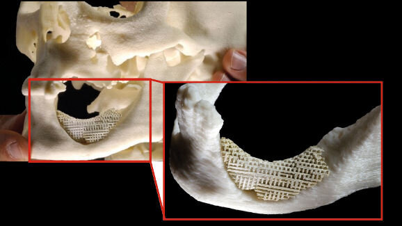 Scientists from Norway develop scaffolding to repair severe teeth and jawbone defects