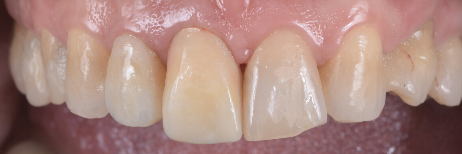 Fig. 13: Situation before the mock-up.