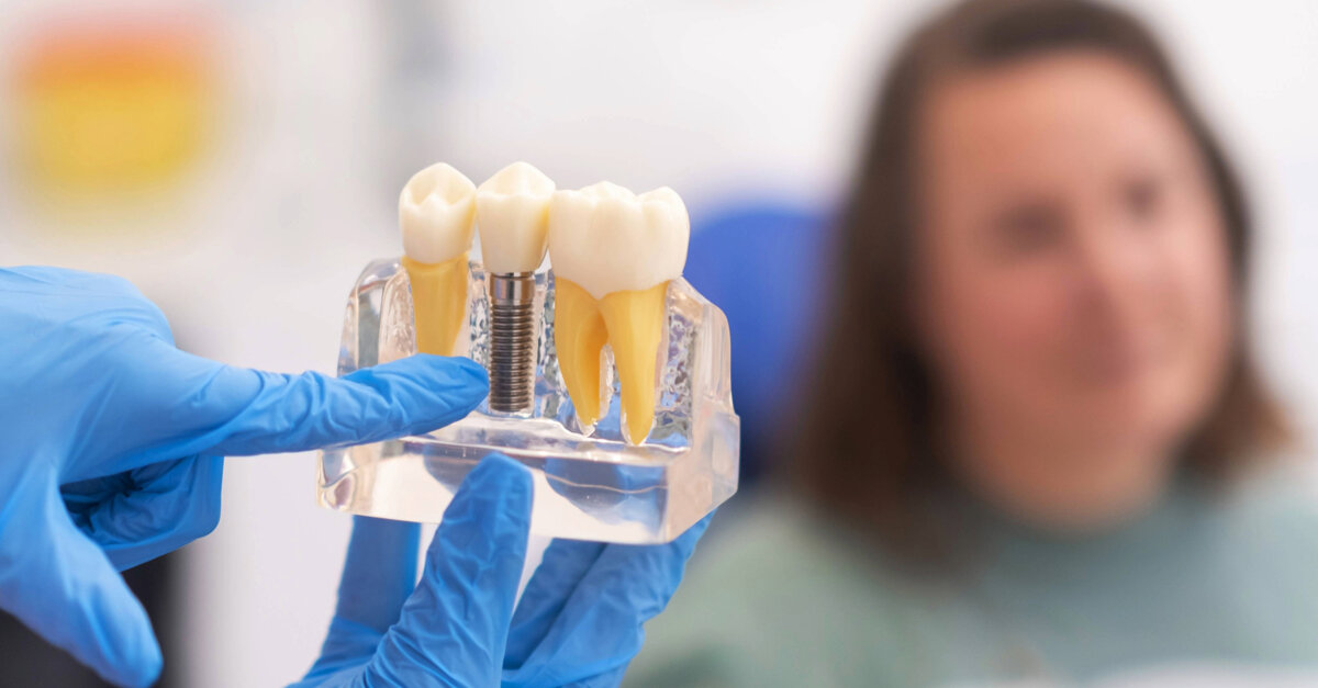 Nieuw prognosesysteem voor implantaten voorspelt vijfjaarsurvival betrouwbaar