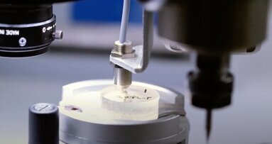 Scientists identify biomarkers for neurological disease in teeth