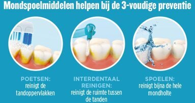 Parodontitis komt vaker voor dan men denkt