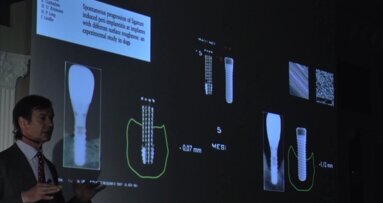 „Kierunki dla implantologii i inżynierii tkankowej” – powierzchnia implantów