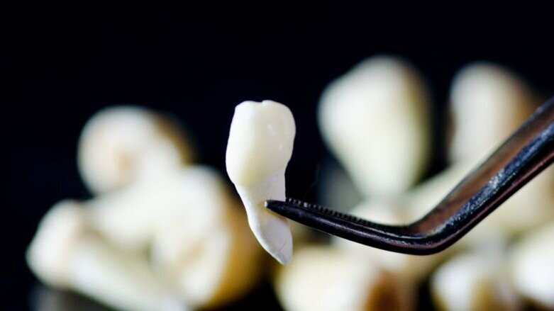 Sporen van lood in tand Neanderthaler