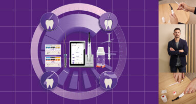 FKG Dentaire launches 4D Workflow for streamlined endodontics