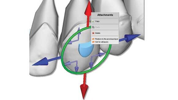 Storing ortho models digitally saves space, dollars