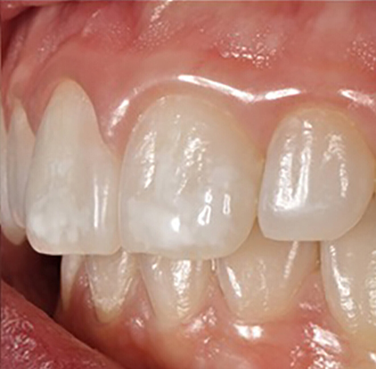 Fig. 2c: Left lateral view.