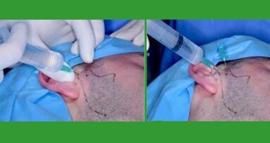 Tratamiento quirúrgico mínimamente invasivo de la ATM (2)