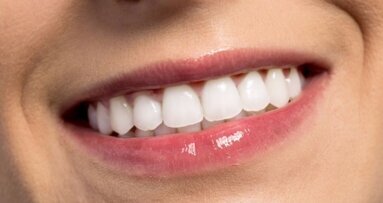 Meer duidelijkheid over cosmetische mondzorg