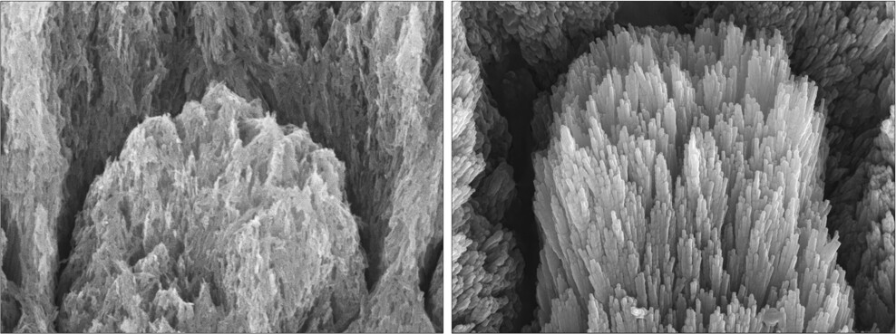 Electron microscopy images of a tooth with demineralised enamel showing eroded apatite crystals (left) and a similar demineralised tooth after a 2-week treatment showing epitaxially regenerated enamel crystals (right). (Image: University of Nottingham)