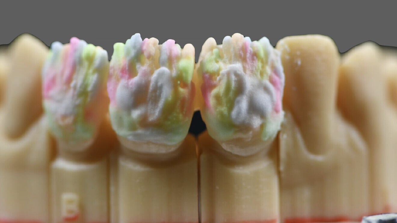 Fig. 3: Beginning of layering according to the CIELAB colour space values.