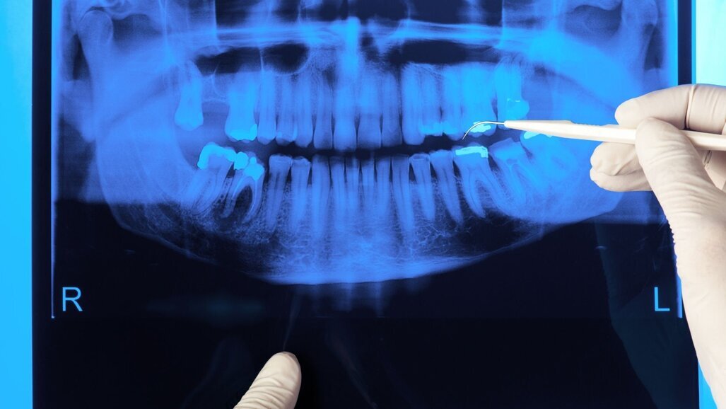 ANVS inspecteert tandartspraktijken